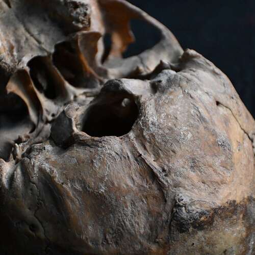 Skull
