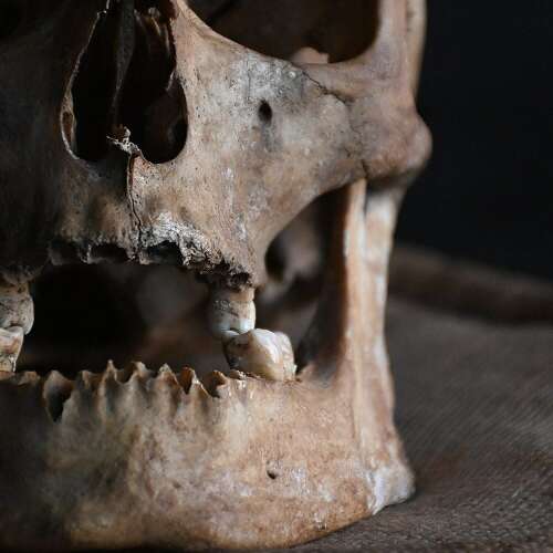 Skull