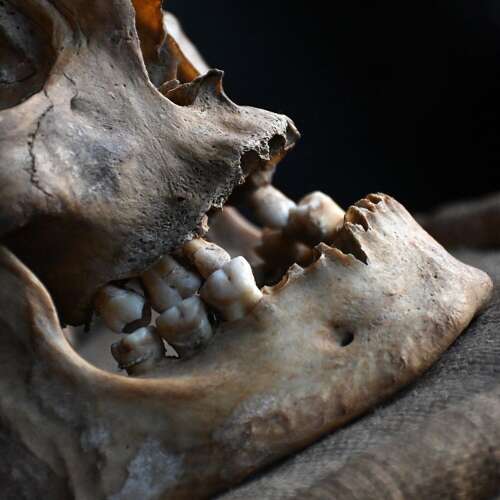Skull