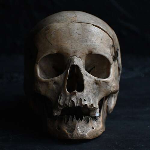 Medical Skull