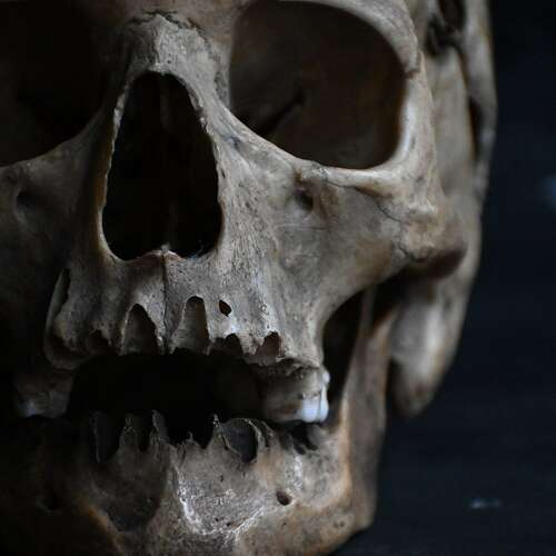 Medical Skull