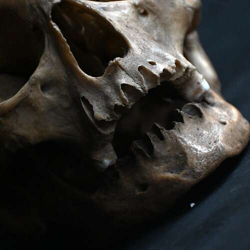 Medical Skull