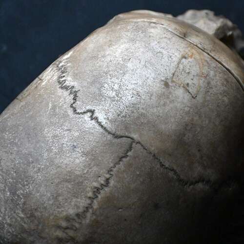 Medical Skull