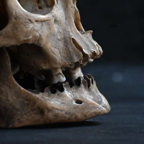 Medical Skull