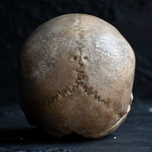 Medical Skull