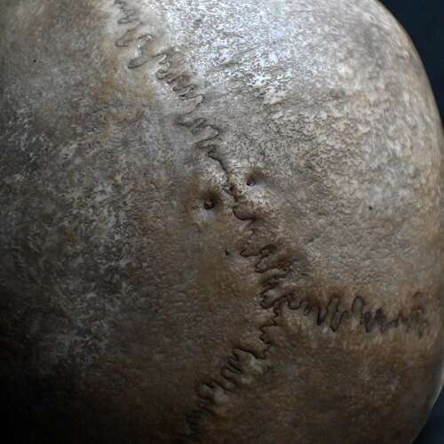 Medical Skull