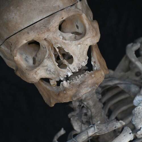 Boney