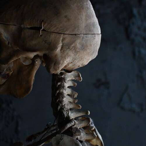 Boney