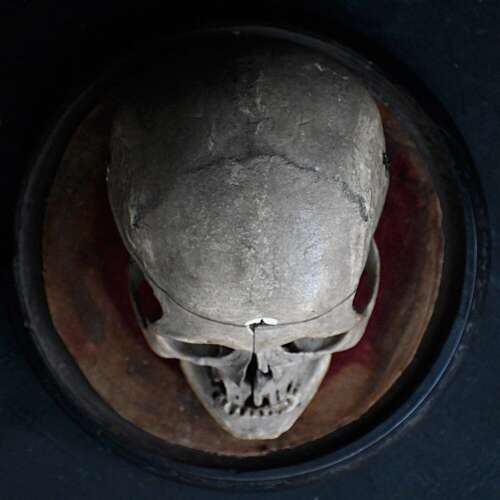 Medical Human Skull