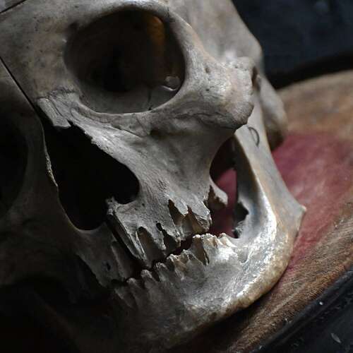 Medical Human Skull
