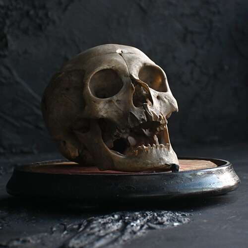 Medical Human Skull