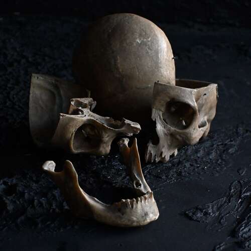 Medical Human Skull