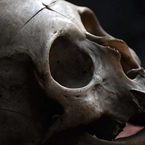 Medical Human Skull