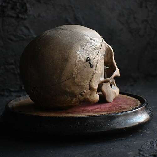 Medical Human Skull