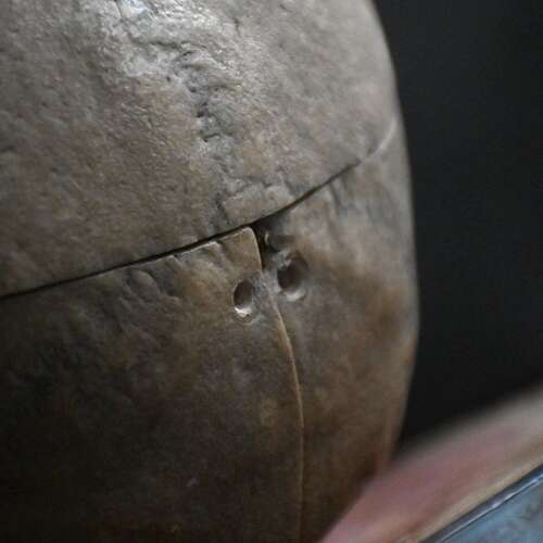 Medical Human Skull