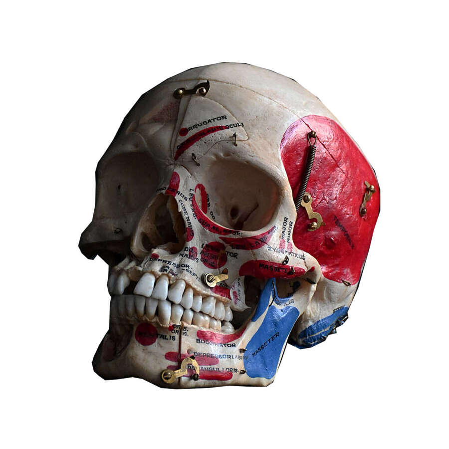 Medical cut skull