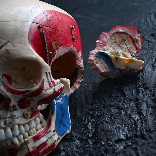 Medical cut skull