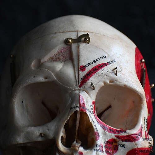 Medical cut skull