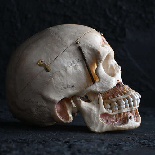 Medical cut skull