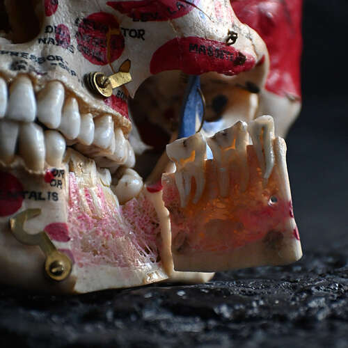 Medical cut skull