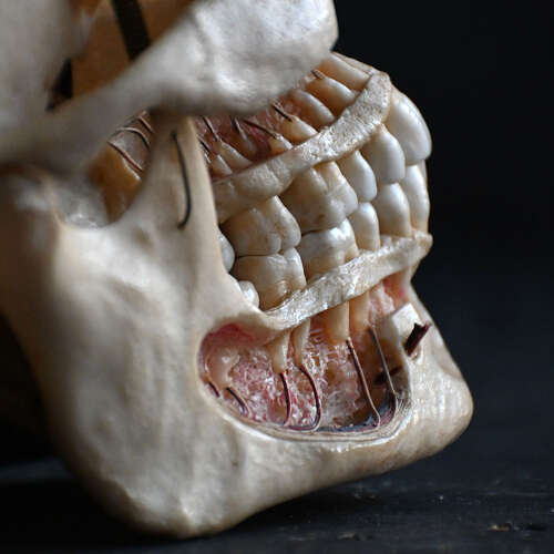 Medical cut skull