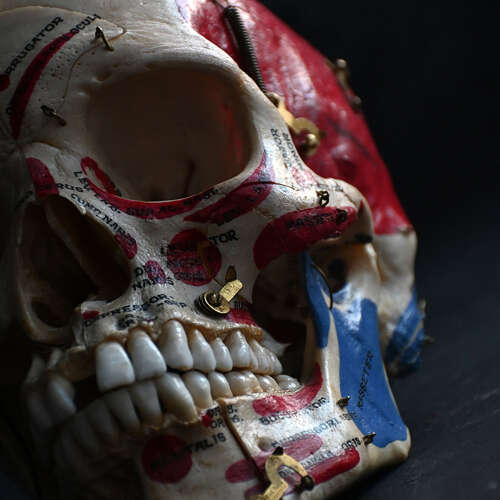 Medical cut skull