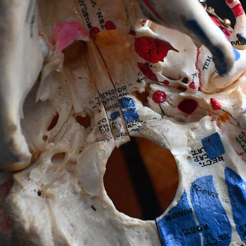 Medical cut skull