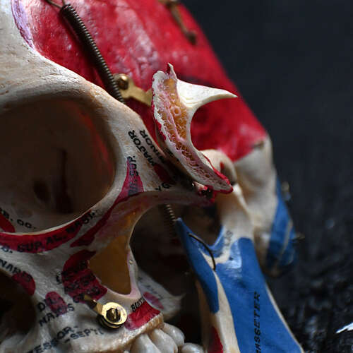 Medical cut skull
